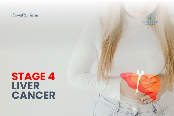 Navigating The Waters Of Stage 4 Liver Cancer What To Expect In 2024 0146