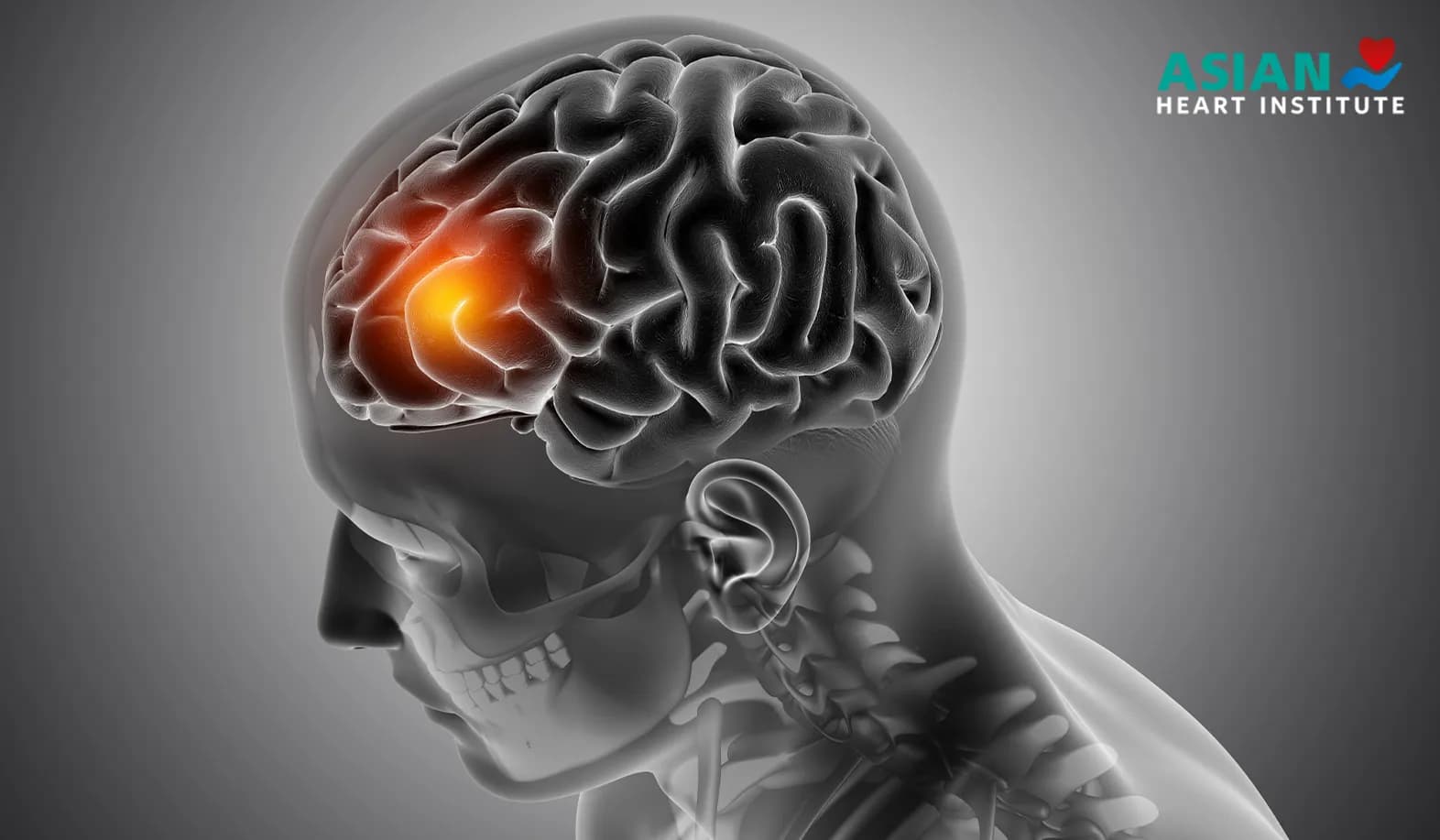 Brain Tumor Surgery