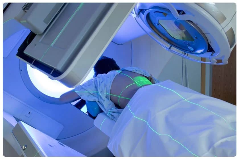 Colorectal Cancer Treatment