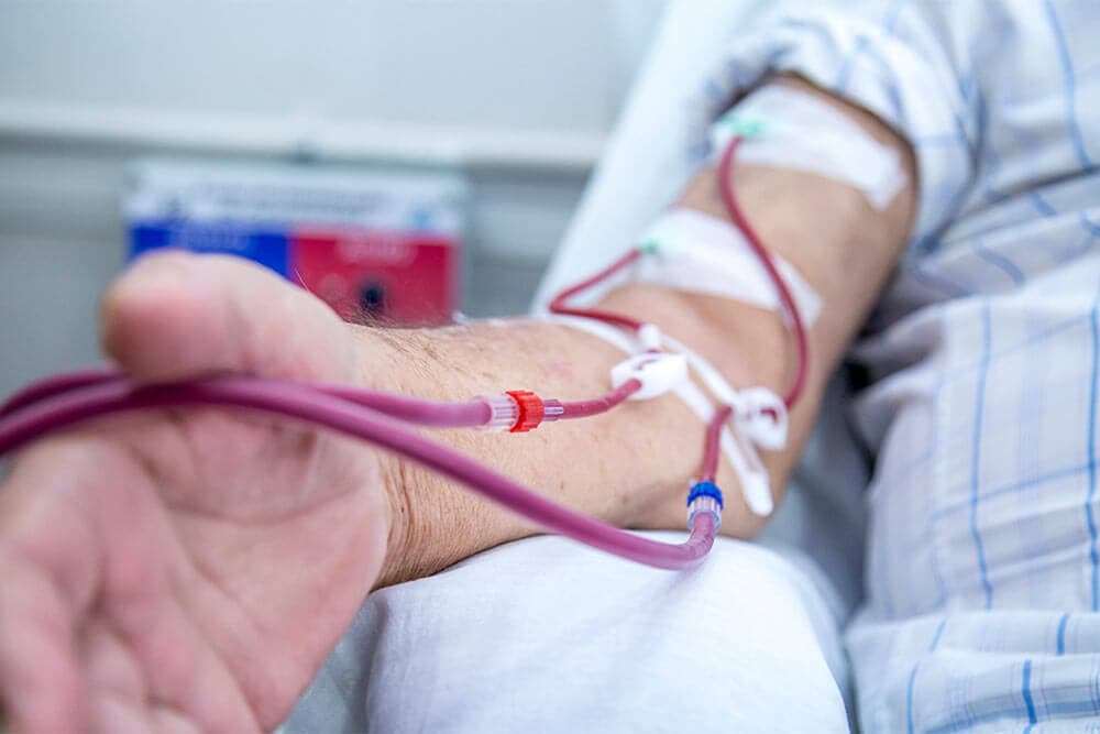 Dialysis Access Surgery