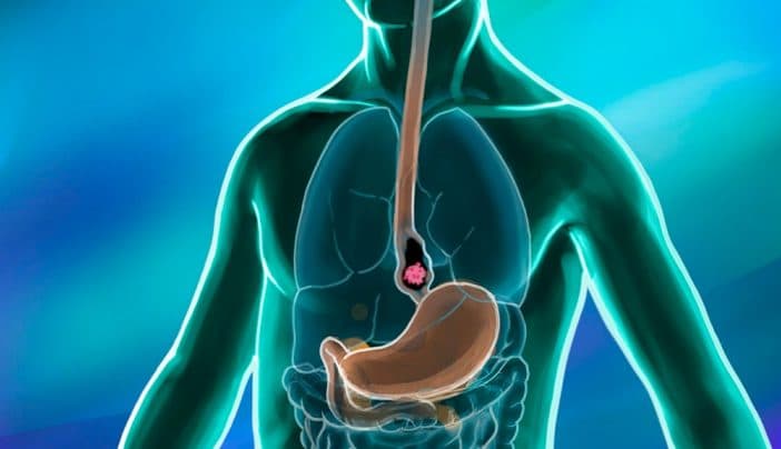 Gastric & Esophageal Cancer Treatment