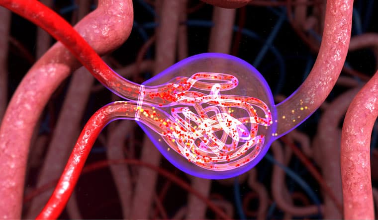 Glomerular Disease Management
