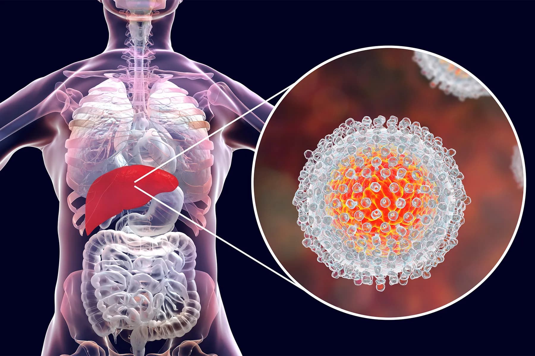 Hepatitis B & C Treatment