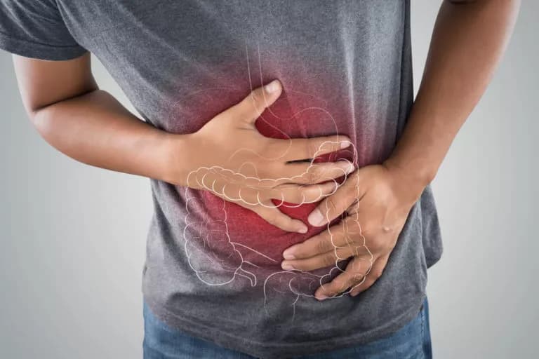Inflammatory Bowel Disease (IBD) Management