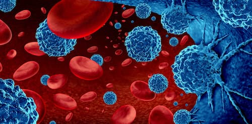 Leukemia, Lymphoma & Blood Cancer Treatment