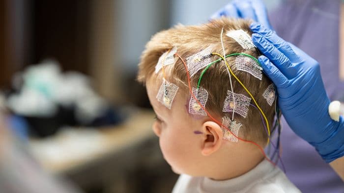Pediatric Neurology & Neurosurgery