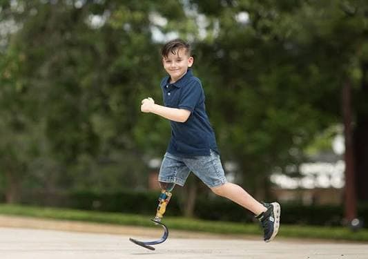 Pediatric Prosthetic Fitting