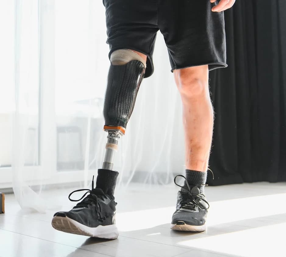 Above-Knee & Below-Knee Limb Prosthetics