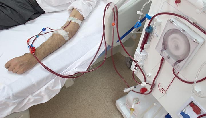 Dialysis (Hemodialysis & Peritoneal)