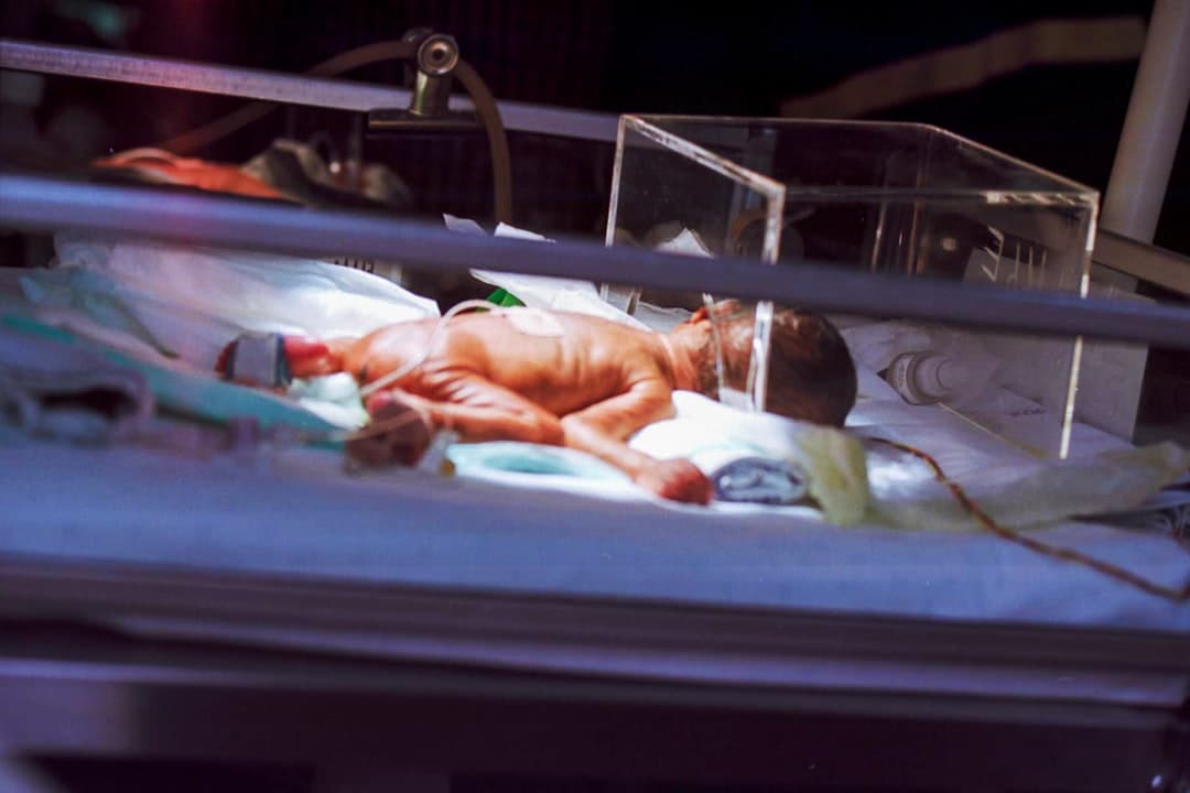 Neonatal Jaundice & Infection Treatment