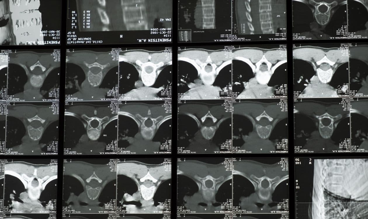 Parathyroid Disorder Treatment