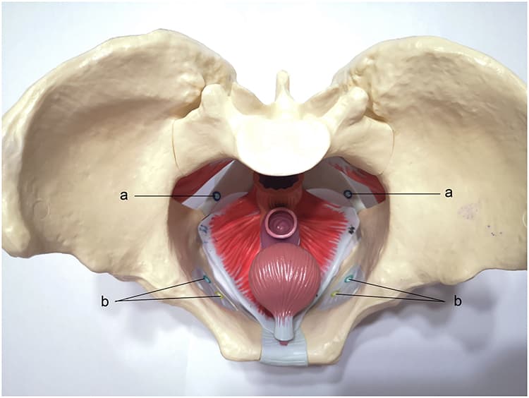 Pelvic Floor Reconstruction