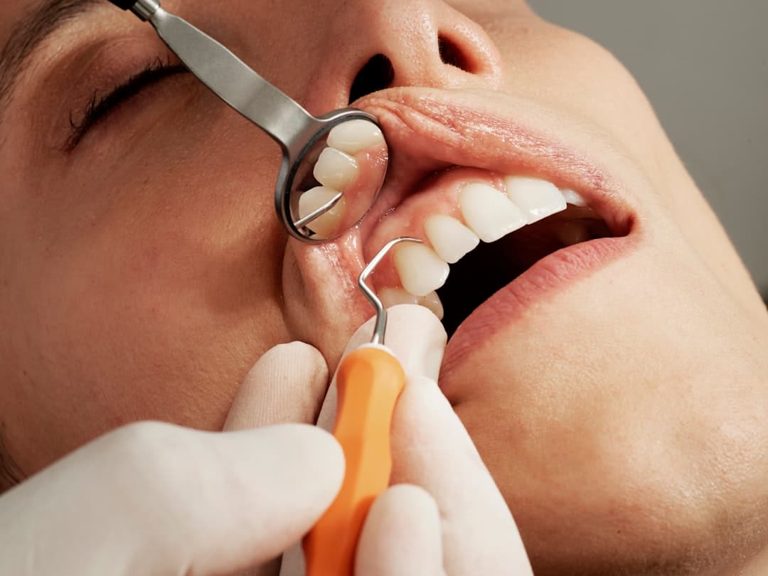 Periodontal & Gum Surgery