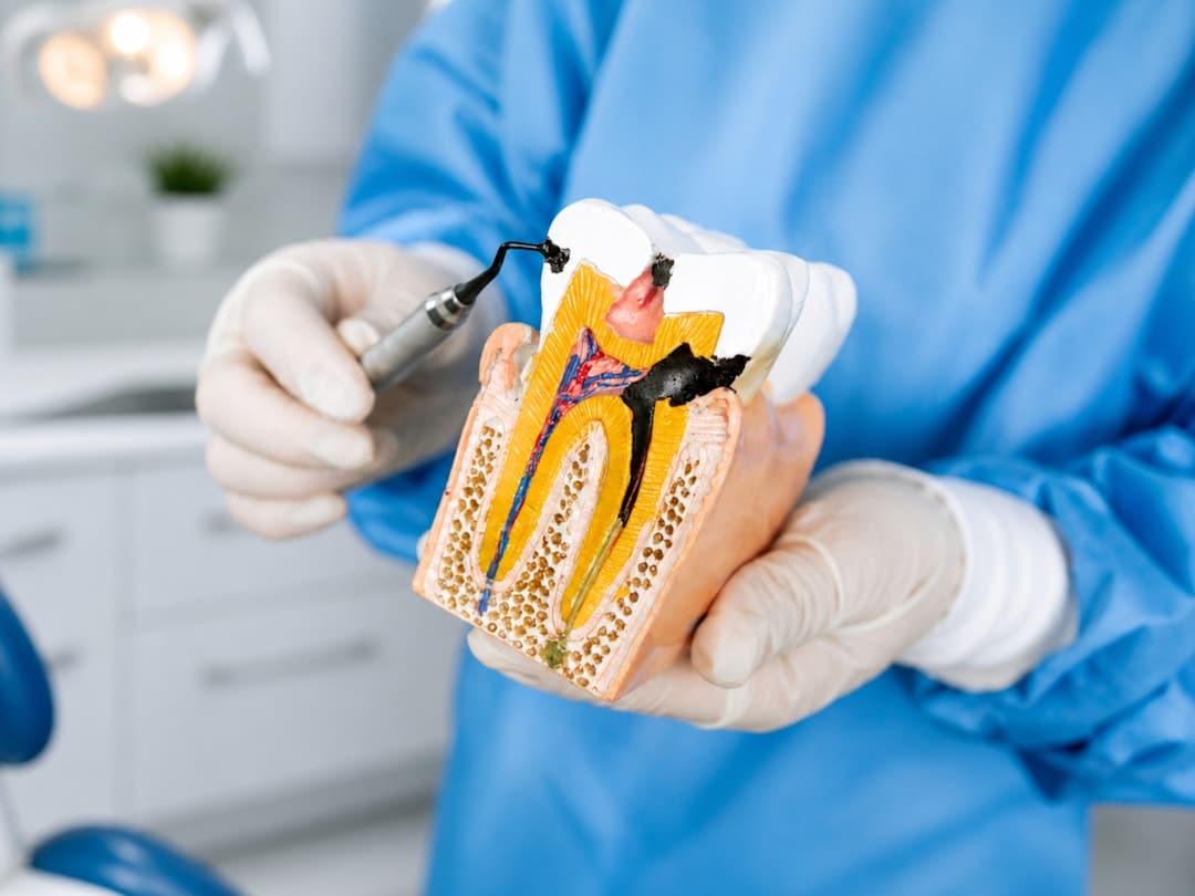 Root Canal Therapy
