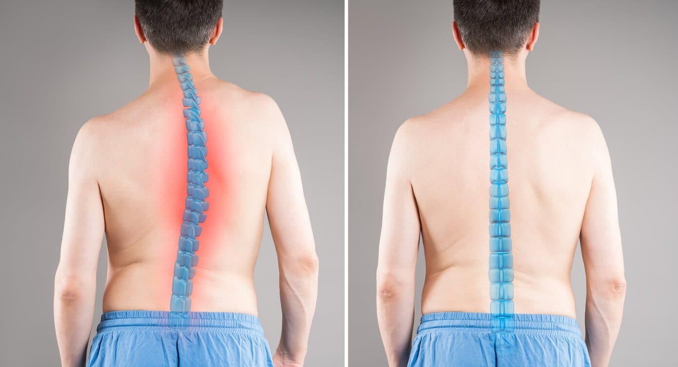 Spinal Surgery