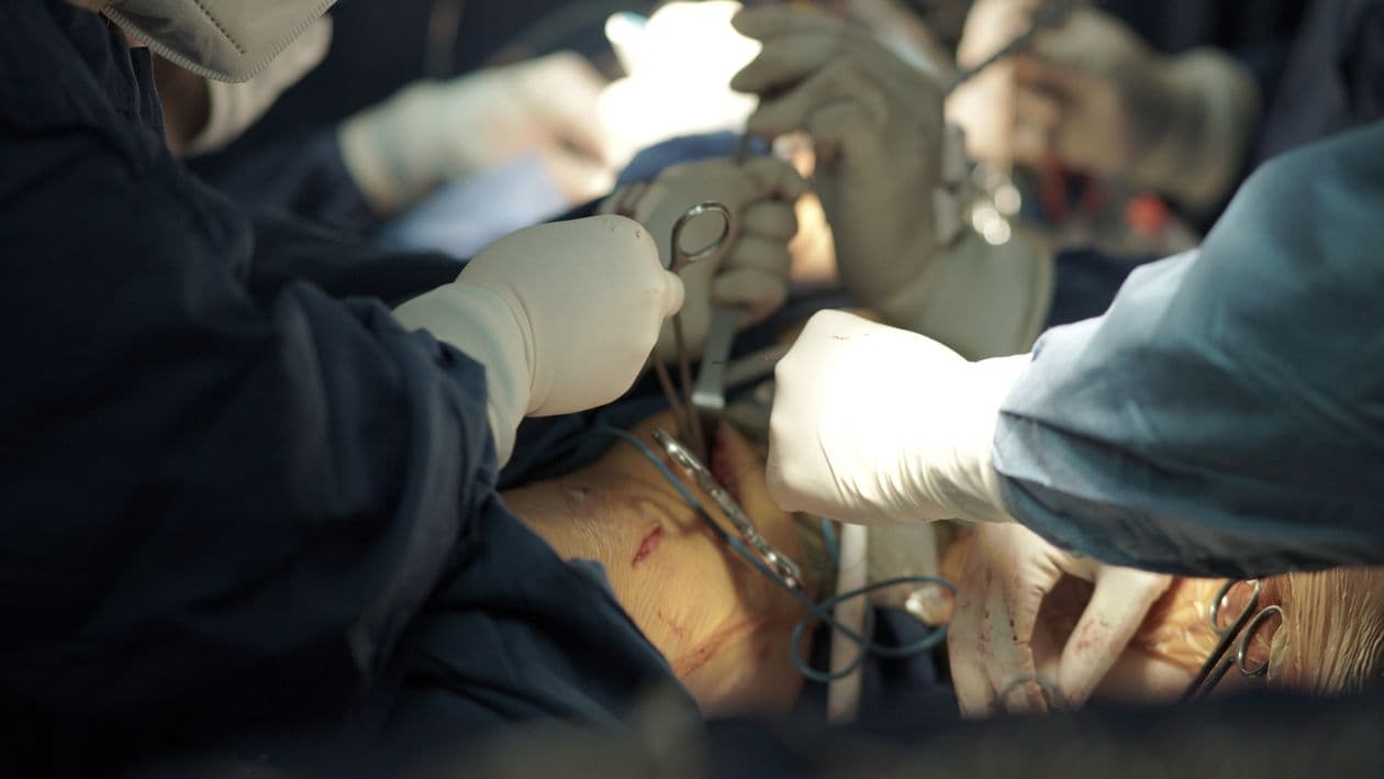 Kidney Transplant